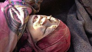 %d9%85%d8%ac%d8%b2%d8%b1%d8%a9-%d8%a7%d9%84%d8%b7%d9%84%d8%ad-%d8%b6%d8%ad%d8%a7%d9%8a%d8%a7-2-1