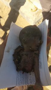 %d8%b7%d9%81%d9%84-%d9%85%d8%b1%d9%85%d9%8a-%d9%81%d9%8a-%d8%b3%d8%b9%d9%88%d8%a7%d9%861