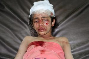 A girl lies on a hospital bed after she was recovered from the site of a Saudi-led air strike in the northwestern city of Saada, Yemen March 13, 2017. REUTERS/Naif Rahmah