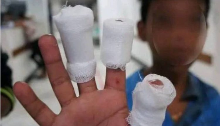 الألعاب النارية تهدد حياة الأطفال في صنعاء